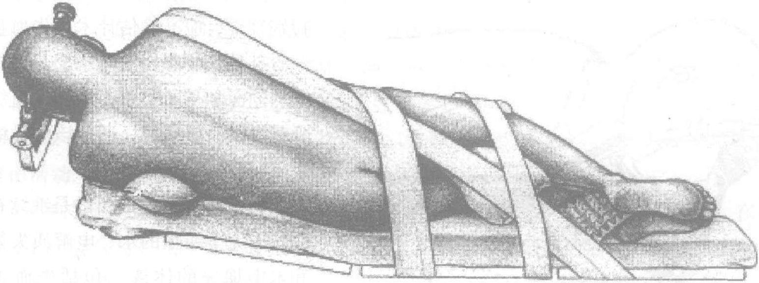 第四節(jié) 麻醉、體位及術(shù)中管理